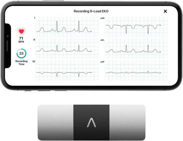 Kardiamobile 6 Lead Personal Ekg Monitor – Six Views Of The